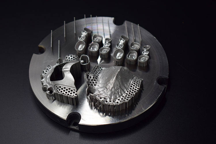 Dental-metal-3D-printing-1